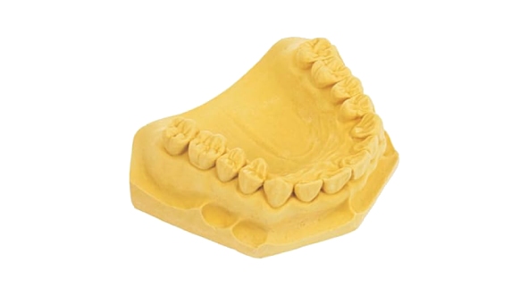 dental cast